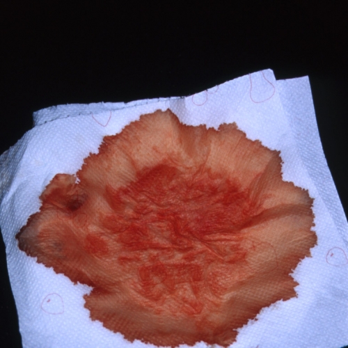 lesen Sie den gesamten Text (in Englisch)